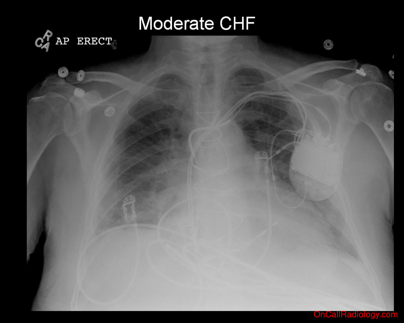 On Call Radiology Common Radiology Findings On Call And In The 