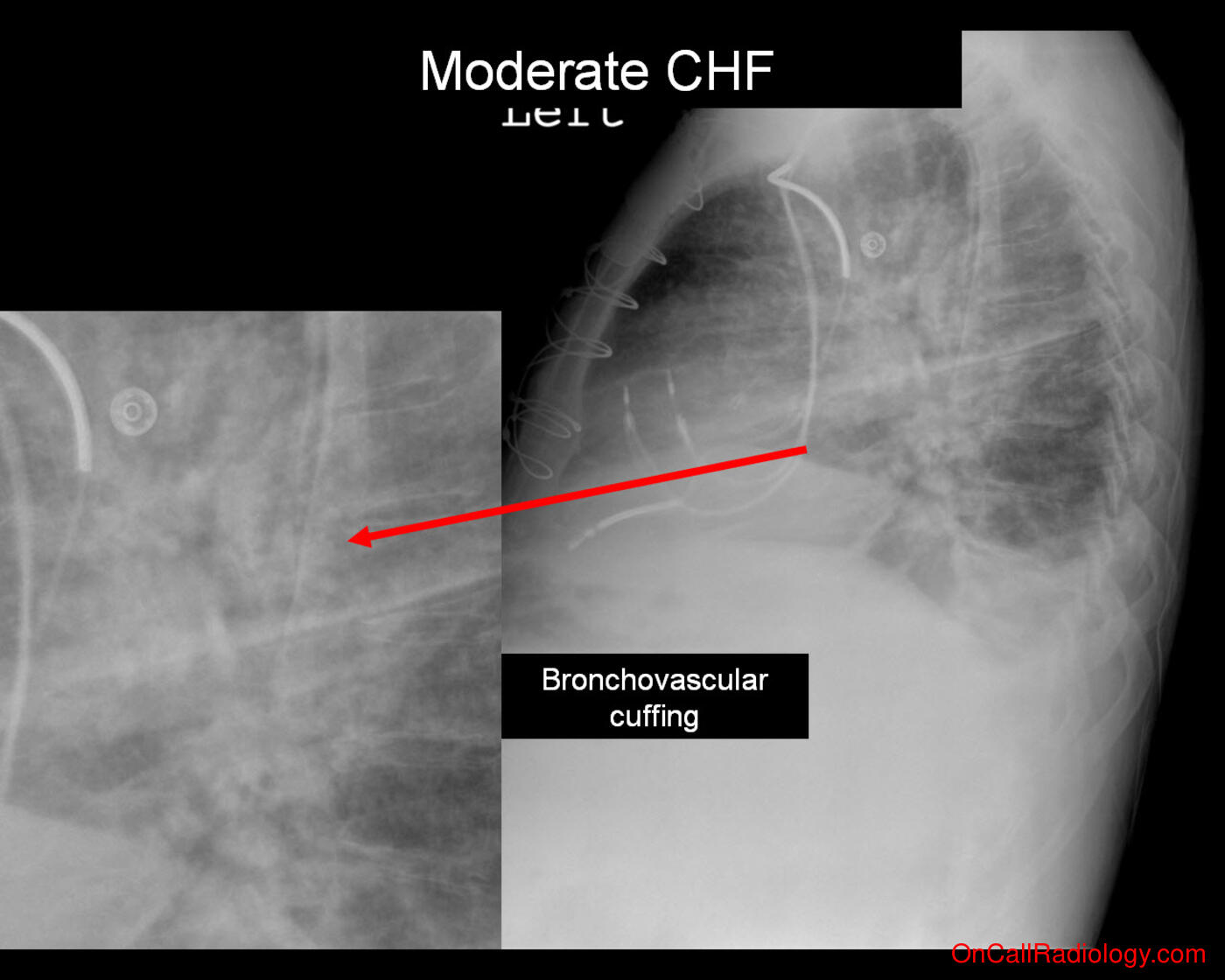 On Call Radiology Common Radiology Findings On Call And In The 